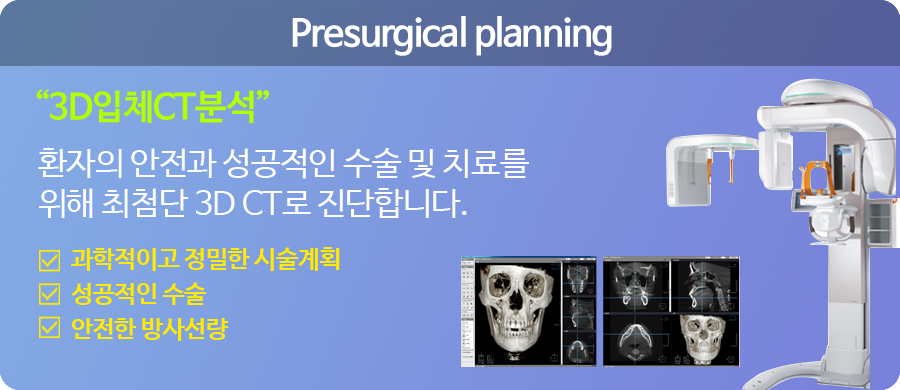 Presurgical planning